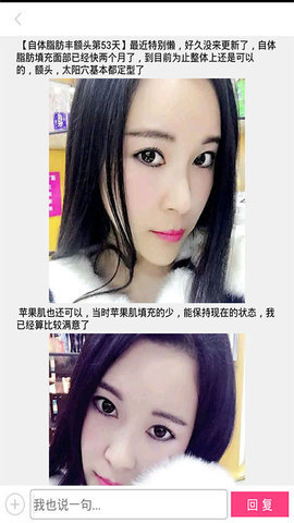 整形去哪儿安卓下载?2: