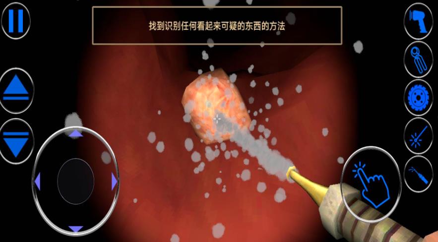 模拟肠道医生免费版图3